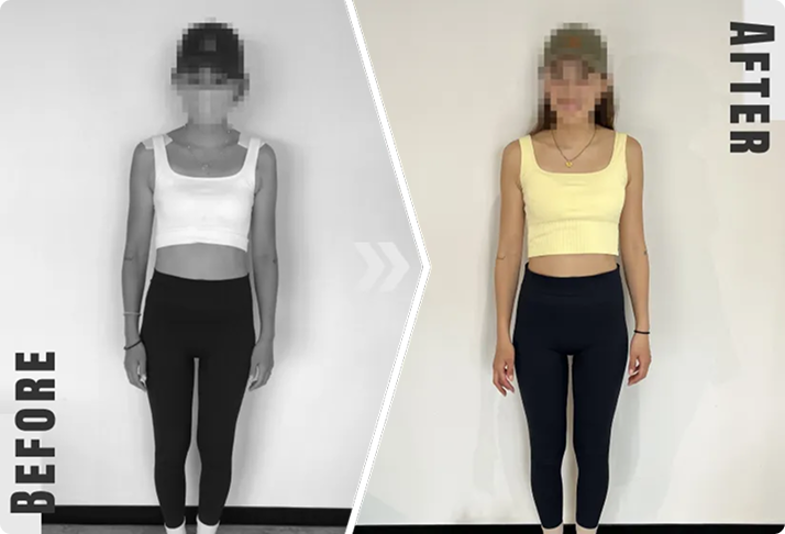 ビフォーアフター写真2